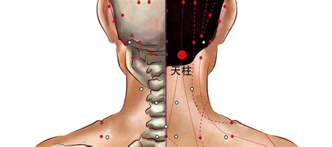 天柱穴氣結|氣結是什麼？氣結判斷與治療從「激痛點」下手！